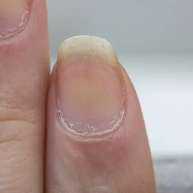 Imitación Alianza biología Secretos de belleza: Cómo desmanchar las uñas de las manos