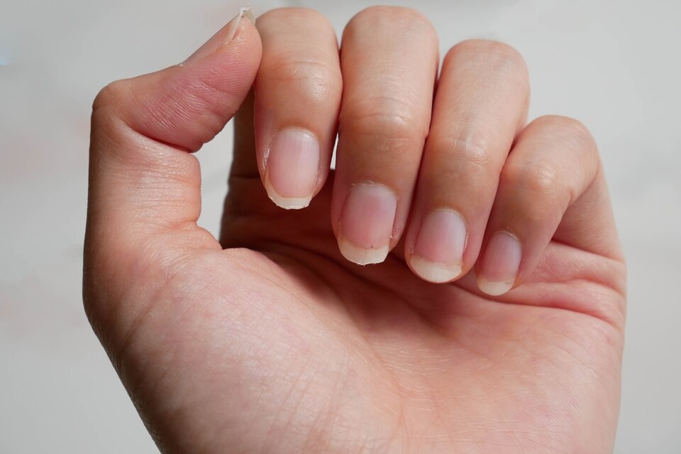 anfitrión Narabar Electrizar Secretos de belleza: Cómo desmanchar las uñas de las manos