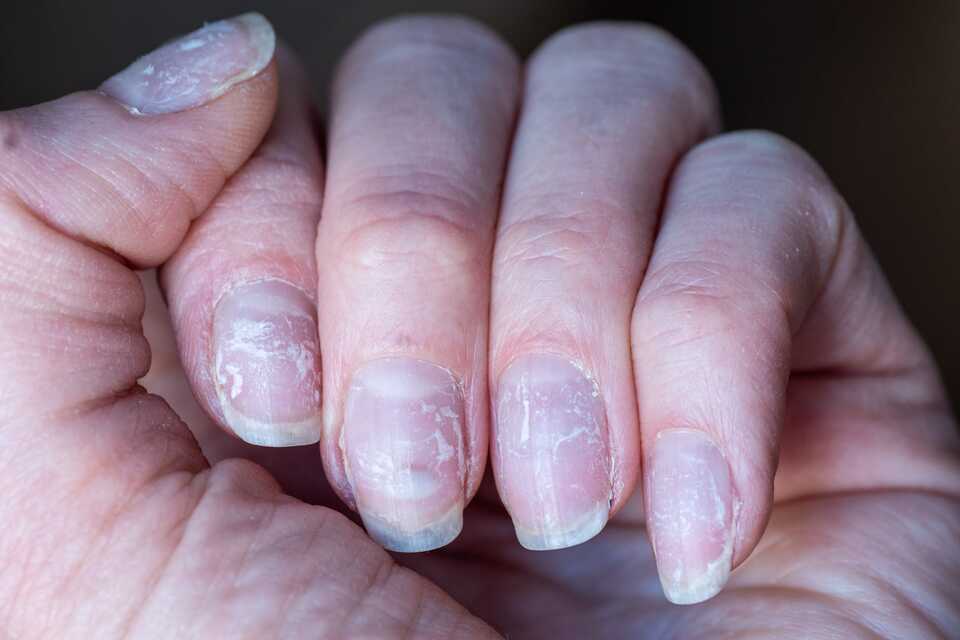 La mejor manera para endurecer las uñas  Mejor con Salud 